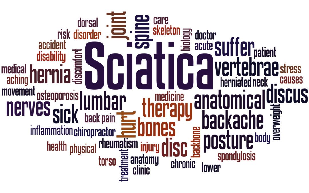 Sciatica pain relief supplements